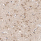 Anti-MPP2 Antibody