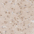 Anti-MPP2 Antibody