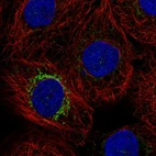 Immunofluorescent staining of human cell line A-431 shows localization to mitochondria.
