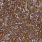 Immunohistochemical staining of human pancreas shows strong cytoplasmic positivity in exocrine glandular cells.