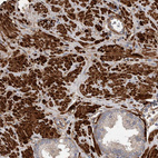 Immunohistochemical staining of human prostate shows strong cytoplasmic positivity in smooth muscle cells.