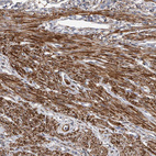 Immunohistochemical staining of human endometrium shows strong cytoplasmic positivity in smooth muscle cells.