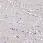 Immunohistochemical staining of human skeletal muscle shows no cytoplasmic positivity in myocytes as expected.