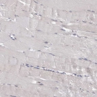 Immunohistochemical staining of human skeletal muscle shows no cytoplasmic positivity in myocytes as expected.