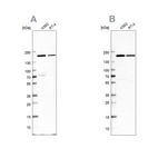Western blot analysis using Anti-EPRS antibody HPA026490 (A) shows similar pattern to independent antibody HPA030052 (B).