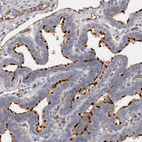 Anti-CD59 Antibody