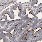 Immunohistochemical staining of human fallopian tube shows strong positivity in cilia in glandular cells.