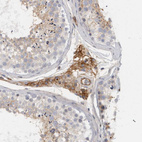 Immunohistochemical staining of human testis shows moderate membranous positivity in Leydig cells.