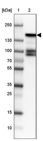 Lane 1: Marker [kDa] 250, 130, 100, 70, 55, 35, 25, 15, 10_br/_Lane 2: Human cell line HEL