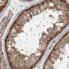 Immunohistochemical staining of human testis shows moderate to strong cytoplasmic positivity in cells in seminiferous ducts.