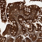 Immunohistochemical staining of human small intestine shows strong cytoplasmic positivity in glandular cells.