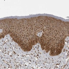 Immunohistochemical staining of human skin shows moderate cytoplasmic positivity in squamous epithelial cells.