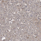 Immunohistochemical staining of human liver shows very weak positivity in hepatocytes as expected.