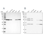Western blot analysis using Anti-STK24 antibody HPA026502 (A) shows similar pattern to independent antibody HPA026435 (B).