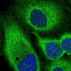 Immunofluorescent staining of human cell line A-431 shows localization to nucleoli & cytosol.