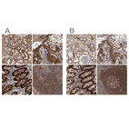 Anti-DARS2 Antibody