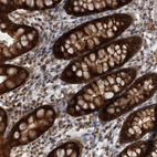 Immunohistochemical staining of human rectum shows strong cytoplasmic positivity in glandular cells.