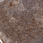Immunohistochemical staining of human lymphoid tissues shows moderate cytoplasmic positivity in non-germinal center cells.