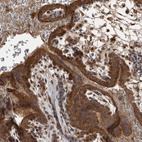 Immunohistochemical staining of human placenta shows moderate cytoplasmic positivity in trophoblastic cells.