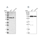 Western blot analysis using Anti-DARS2 antibody HPA026506 (A) shows similar pattern to independent antibody HPA026528 (B).
