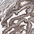 Anti-FSBP Antibody