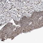 Immunohistochemical staining of human skin shows moderate nuclear positivity in squamous epithelial cells.