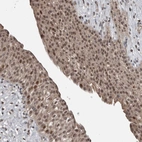 Immunohistochemical staining of human urinary bladder shows strong nuclear positivity in urothelial cells.