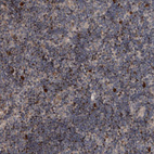 Immunohistochemical staining of human lymph node shows strong nuclear positivity in subset of non-germinal center cells.