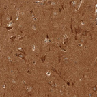Immunohistochemical staining of human cerebral cortex shows strong cytoplasmic positivity in neurons.