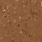 Immunohistochemical staining of human cerebral cortex shows strong cytoplasmic positivity in neurons.