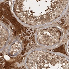Immunohistochemical staining of human testis shows strong cytoplasmic positivity in Leydig cells.