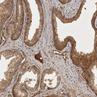 Immunohistochemical staining of human prostate shows moderate cytoplasmic positivity in glandular cells.
