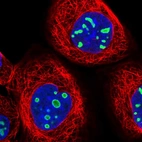Immunofluorescent staining of human cell line A-431 shows localization to nucleoli.