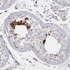 Anti-FNDC8 Antibody