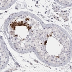 Anti-FNDC8 Antibody