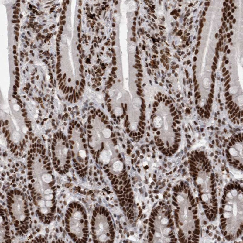 Anti-SNRNP40 Antibody