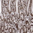 Anti-SNRNP40 Antibody