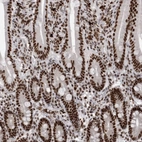 Anti-SNRNP40 Antibody