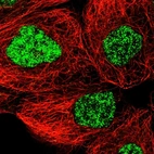 Immunofluorescent staining of human cell line A-431 shows localization to nuclear speckles.