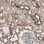 Immunohistochemical staining of human kidney shows moderate cytoplasmic positivity in cells in tubules.