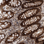 Immunohistochemical staining of human rectum shows strong cytoplasmic positivity in glandular cells.