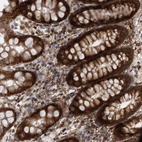 Immunohistochemical staining of human rectum shows strong cytoplasmic positivity in glandular cells.