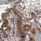 Immunohistochemical staining of human placenta shows moderate cytoplasmic positivity in trophoblastic cells.