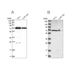 Western blot analysis using Anti-DARS2 antibody HPA026528 (A) shows similar pattern to independent antibody HPA026506 (B).