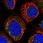 Immunofluorescent staining of human cell line A-431 shows localization to vesicles.