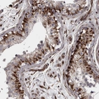 Anti-FAAP100 Antibody