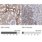 Anti-DBT Antibody