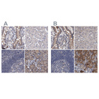 Immunohistochemical staining of human colon, liver, lymph node and pancreas using Anti-DBT antibody HPA026533 (A) shows similar protein distribution across tissues to independent antibody HPA026481 (B).