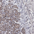 Immunohistochemical staining of human pancreas shows low expression as expected.