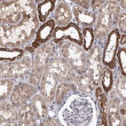 Anti-DBT Antibody